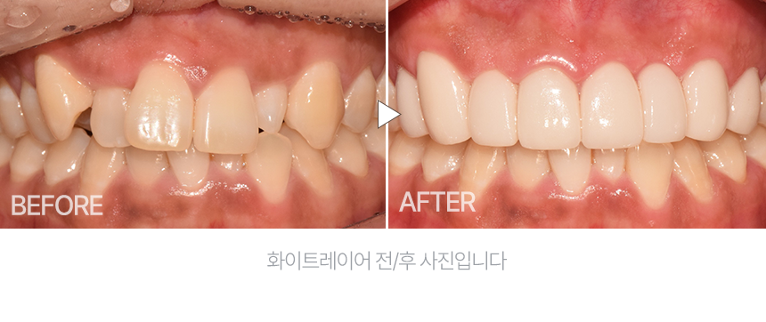 랜딩 이미지 1-2