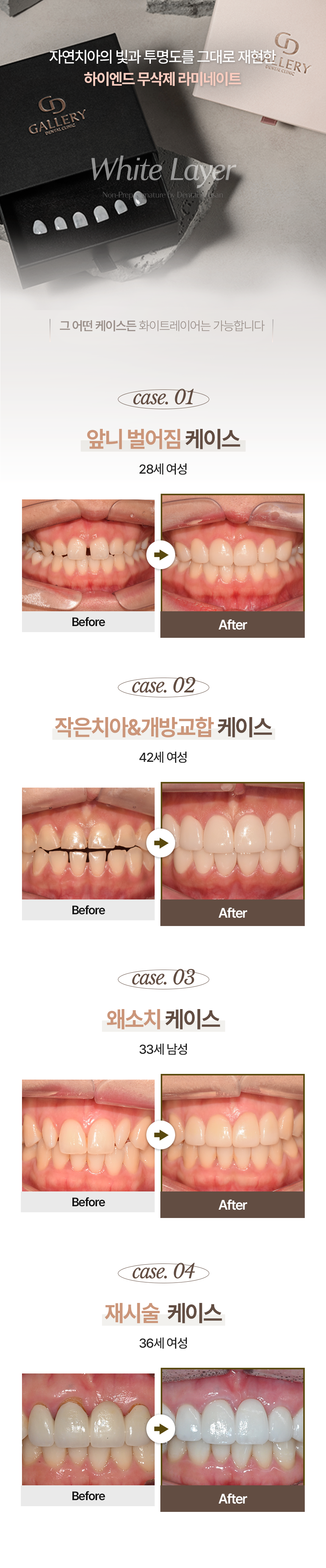랜딩 이미지 2